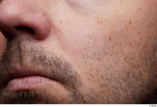  HD Face Skin Raul Conley cheek face lips mouth nose skin pores skin texture 0002.jpg
